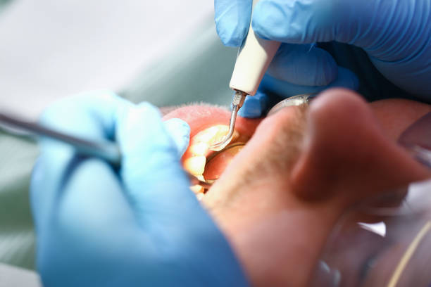 Best Emergency Gum Treatment in West Middlesex, PA